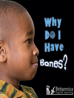 cover image of Why Do I Have Bones?